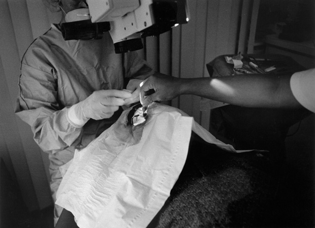 CataractSurgery7 - 1997